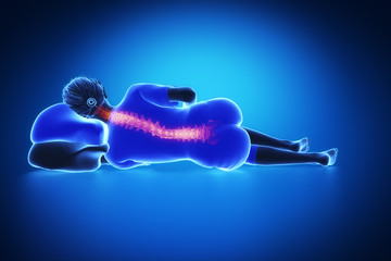 Woman bad incorrect sleep posture