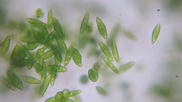 Motion of single-celled protozoa (Euglena) under microscope