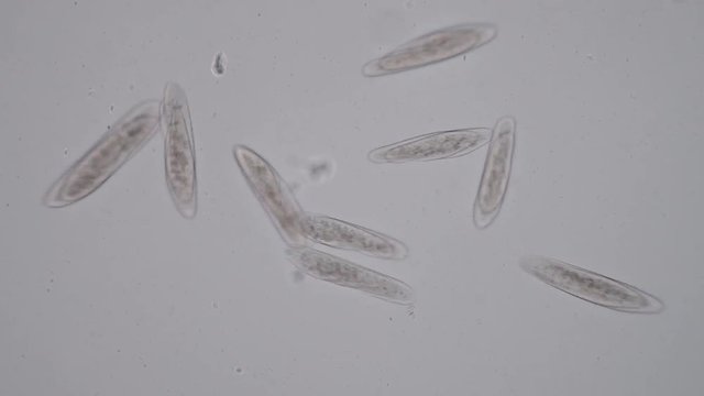Motion of single-celled protozoa (Paramecium) under microscope