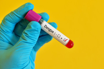 Obraz premium Blood sample positive with dengue virus test 