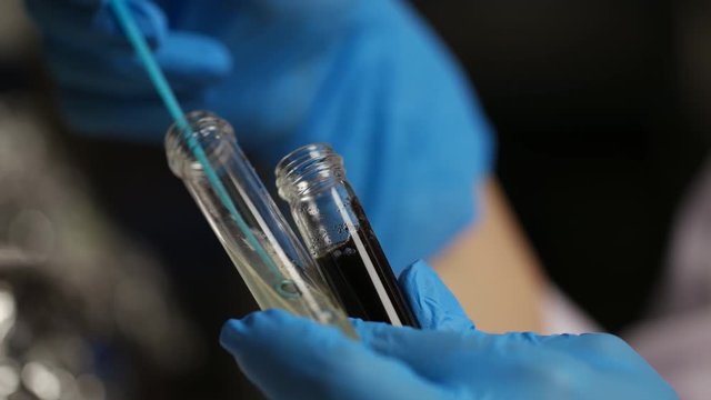 Lab worker working with test tubes with fungus at the laboratory. Colonies of Fungus spore culture on potatoes dextrose agar plate contains small light grains in experimental