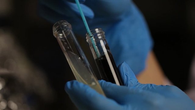 Lab worker working with test tubes with fungus at the laboratory. Colonies of Fungus spore culture on potatoes dextrose agar plate contains small light grains in experimental. Slow motion