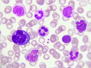 White blood cells in peripheral blood smear, Wright stain