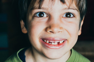 Young boy with missing teeth smiling