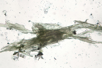 Freshwater cyanobacteria Aphanizomenon by microscope. Green water cause. The sample is pressed with...
