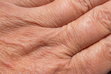 Texture of the skin with wrinkles on the body of mature male