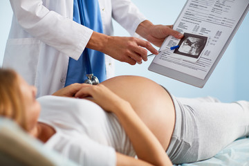 Scan od baby