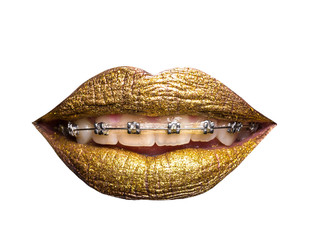 golden metallized female lips with braces