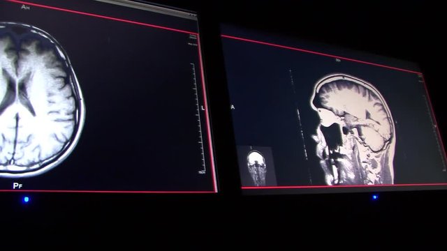 Computerized Axial Tomography Scan CAT. Doctor Analysis in monitors