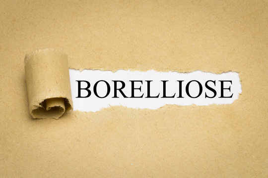 Borelliose