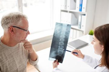 doctor with spine x-ray and senior man at hospital - obrazy, fototapety, plakaty