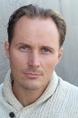 Obraz premium Closeup of man with irritated red bloodshot eyes