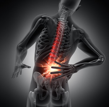 Akute Rückenschmerzen