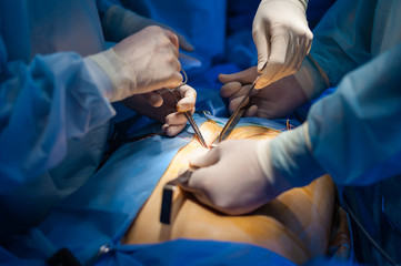 Operation using laparoscopic equipment