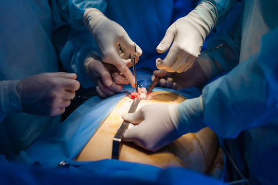 Operation using laparoscopic equipment