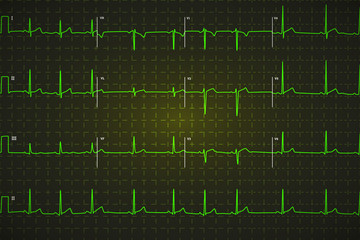 Typical human electrocardiogram, bright green graph on dark background