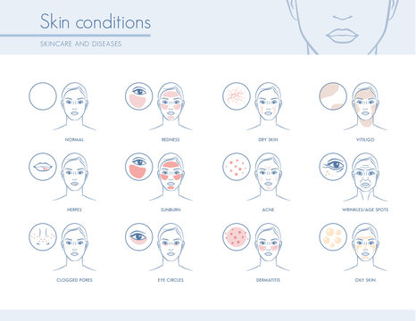 Skin conditions