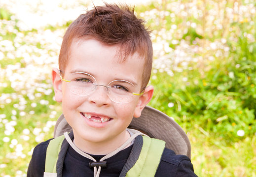 Smiling child with missing front teeth