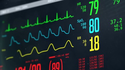 Normal vital signs on bedside ICU monitor, patient stable after heart surgery
