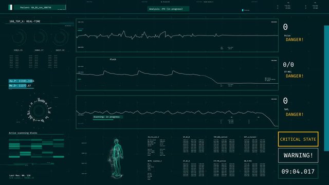 ICU monitor with warning message, patient dying, vital signs dropping on screen
