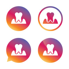 Parodontosis tooth sign icon. Dental care symbol.