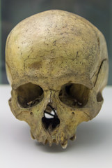details of a human skull