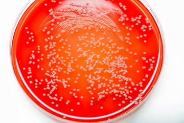 Bacterial colonies culture on Blood agar (BA agar).