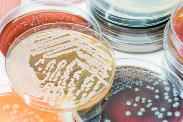Bacterial culture growth on selective media.