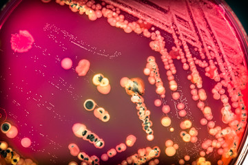 Bacterial colonies culture on  selective agar media(SS agar).