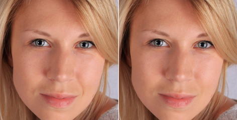 Anti aging skin care results. 30 years old woman with and without aging singes, wrinkles