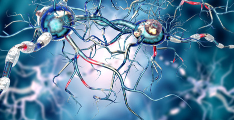      Damaged nerve cells, concept for neurodegenerative and neurological disease, tumors, brain surgery. 