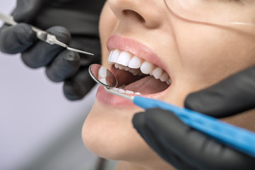 Patient's teeth checking