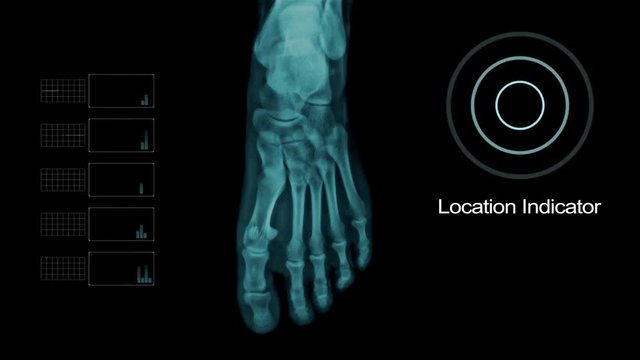 Biometric Scanning Foot Under X- Ray with other Elements