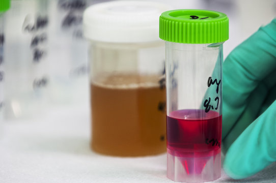 Close-up of samples in container
