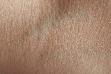 Fototapeta premium macro of blood vein