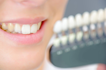 Lady smiling next to teeth samples