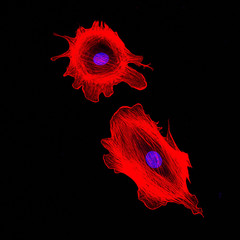 Confocal microscopy imaging of two cancer cells. Cytoskeletal proteins in red, nucleus in blue