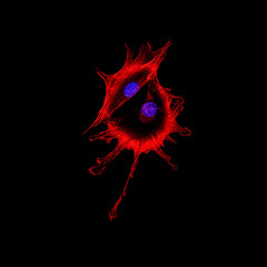Confocal microscopy imaging of two cancer cells touching each other