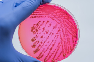 Bacterial colonies culture on  Differential and Selective media