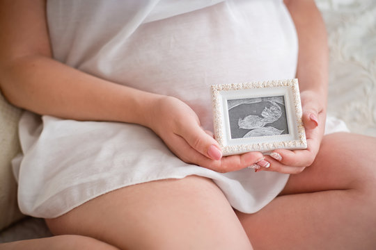 Ultrasonography picture in hands of the pregnant woman