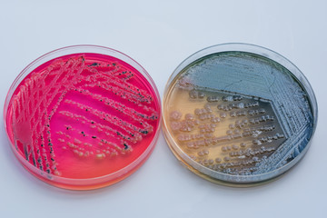 Bacterial colonies culture on  selective agar media XLT Agar (Xy