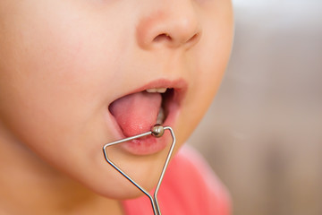 Little girl in class with a speech therapist . The use of special tools for speech correction.