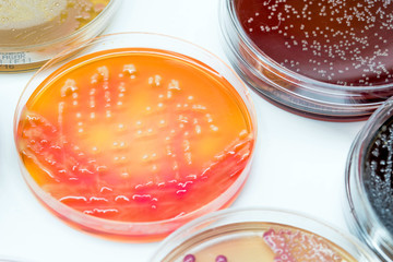 Bacterial culture growth on Salmonella Shigella Agar.