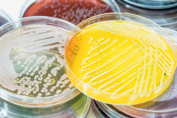 Bacterial culture growth on selective media.
