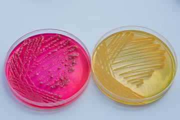 Bacterial colonies culture on  selective agar media XLT Agar (Xy