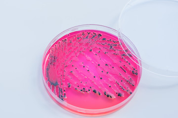 Bacterial colonies culture on  selective agar media XLT Agar (Xy