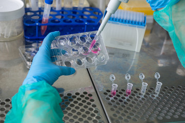 Young woman pipetting sample of human cells