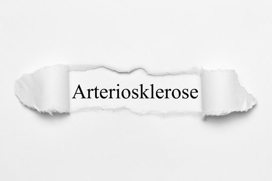 Arteriosklerose auf wei&szlig;en gerissenen Papier