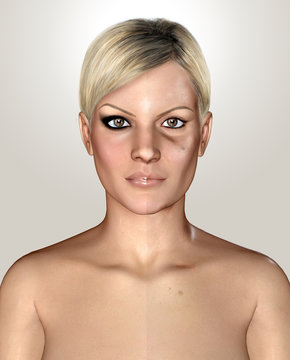 3d illustration of a same healthly and damaged skin