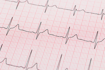 Elektrokardiogramm EKG Aufzeichnung der Herzfrequenz
